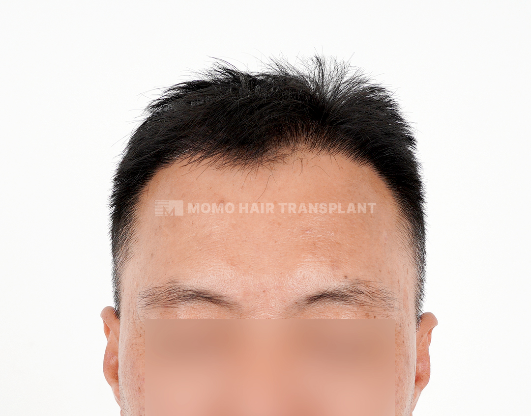 After