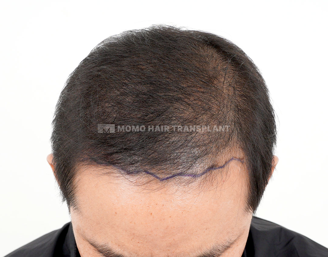 Before