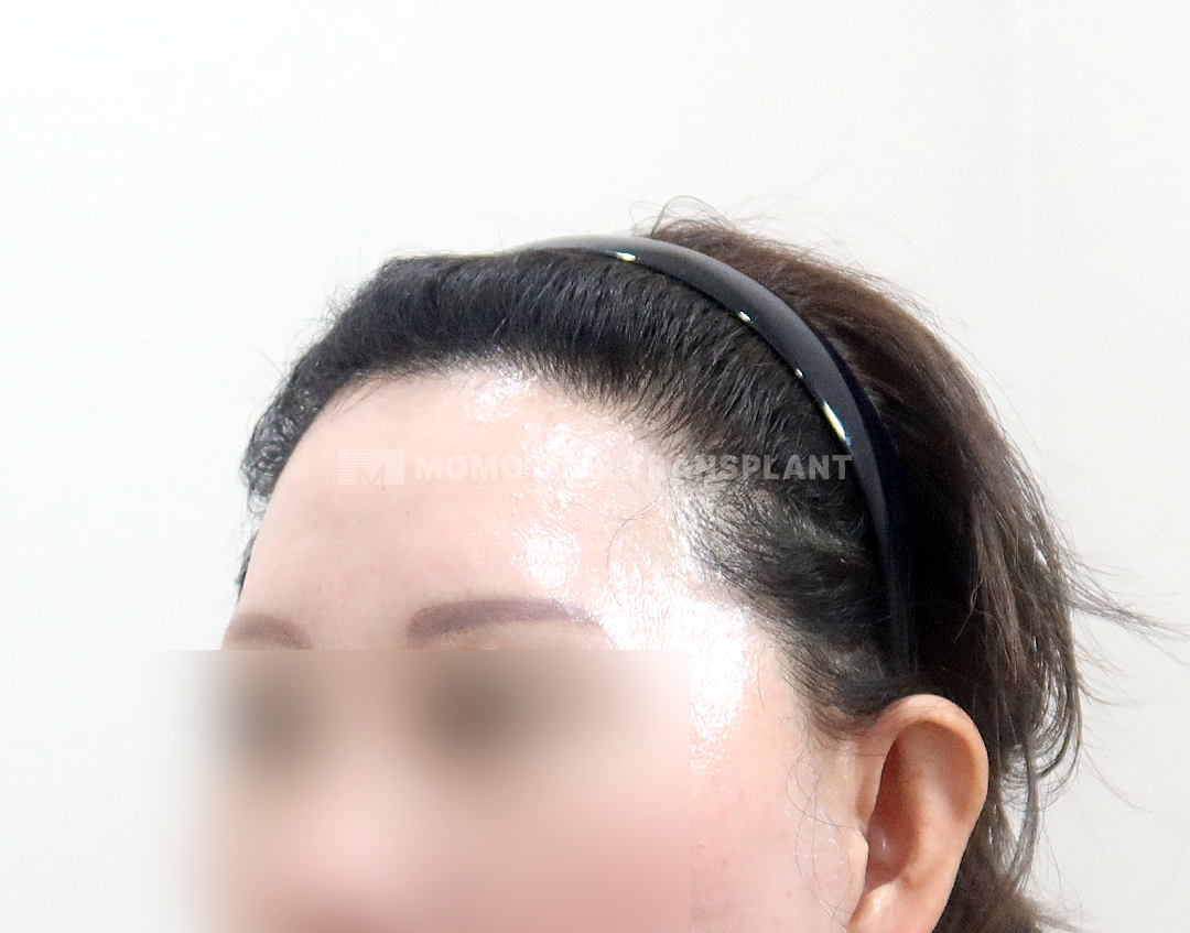 After
