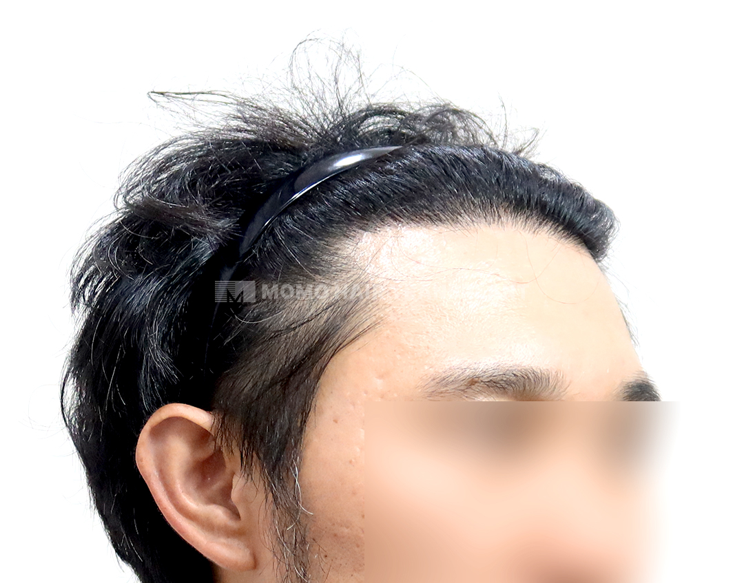 After