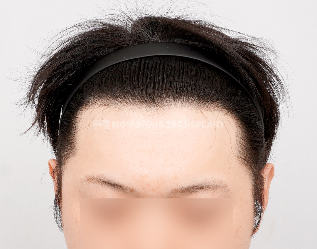 After