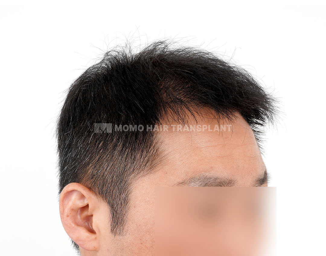 After