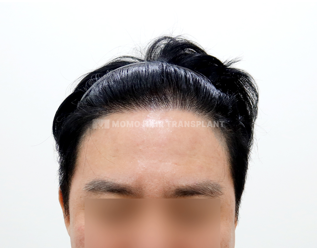 After