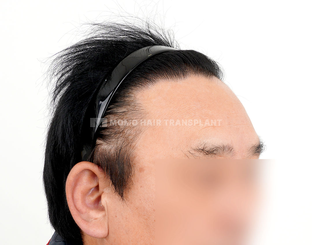 After