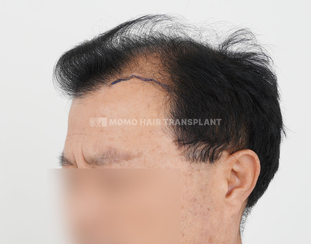 Before