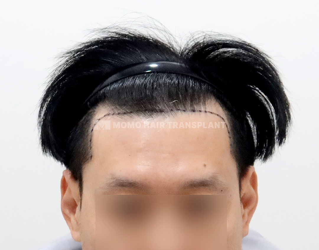 Before