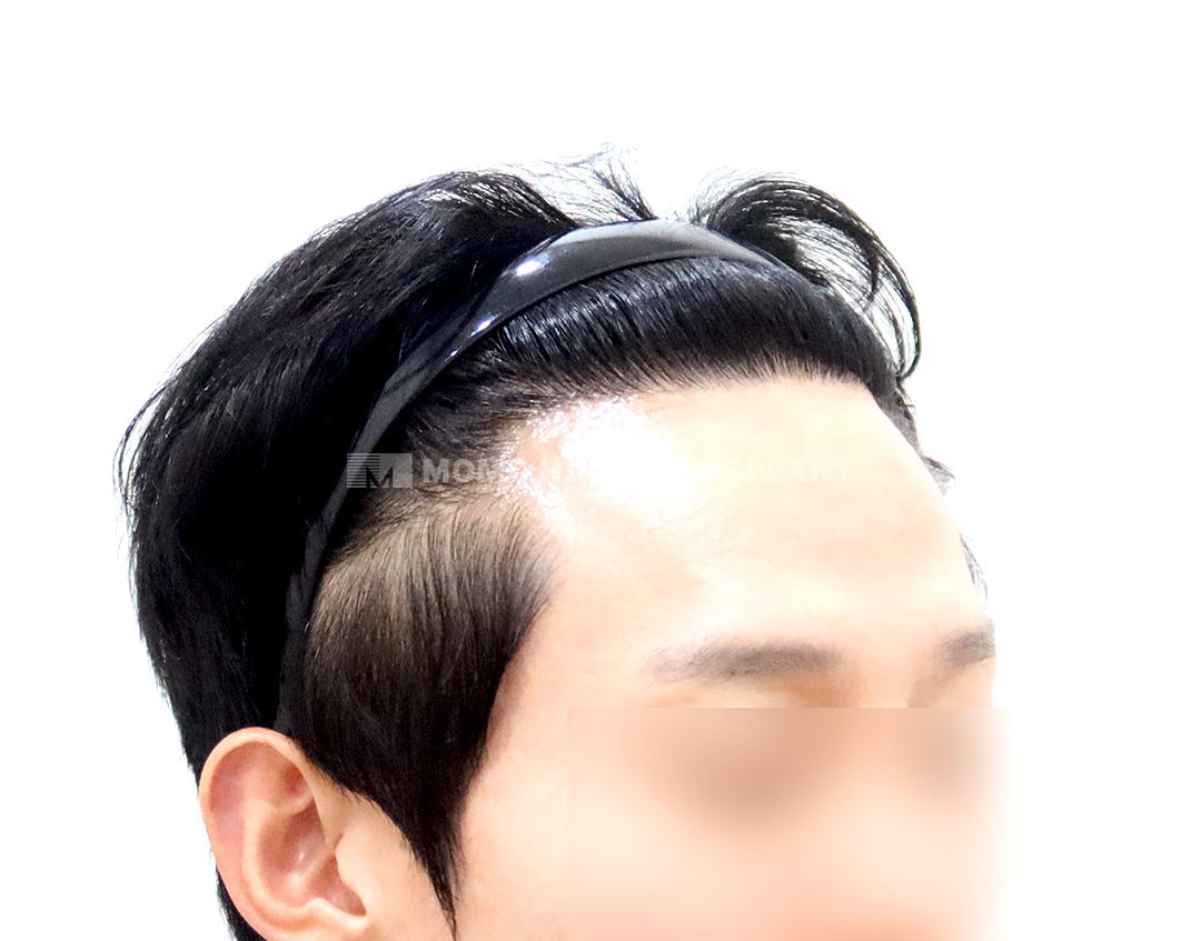 After