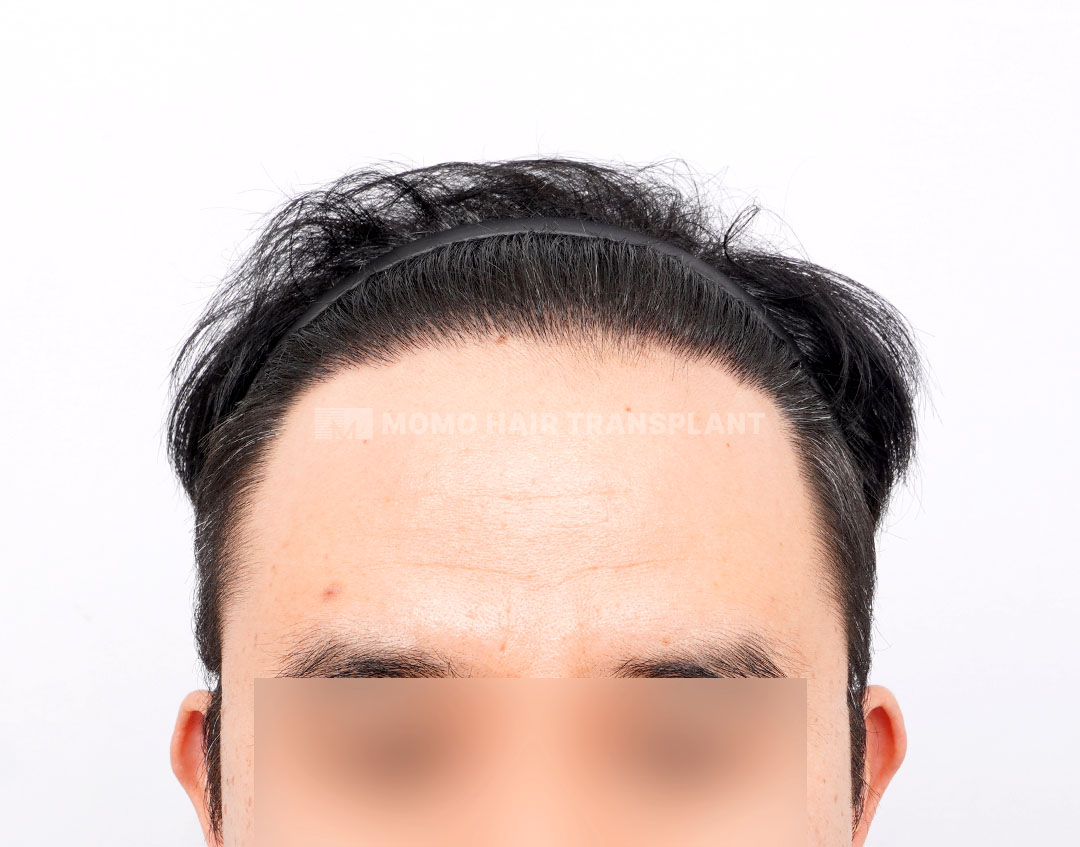 After