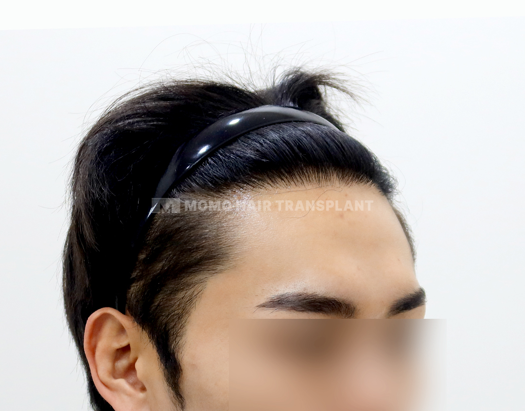 After