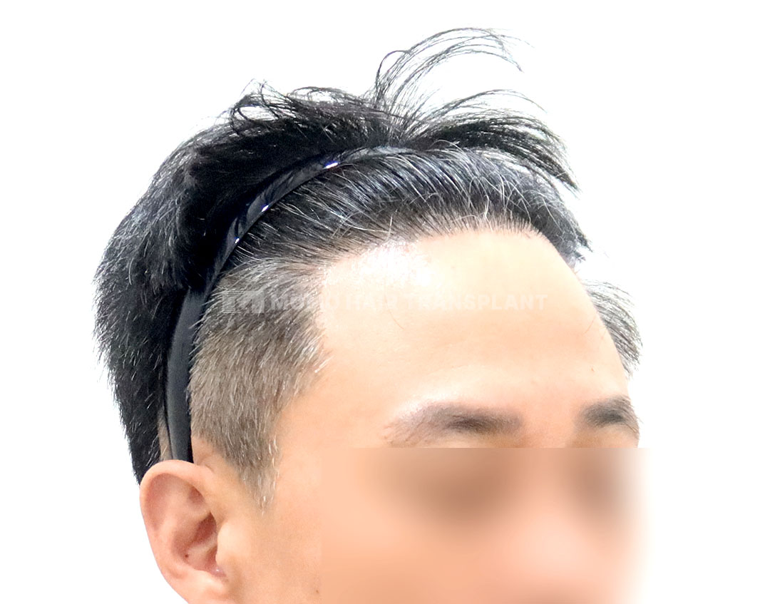 After