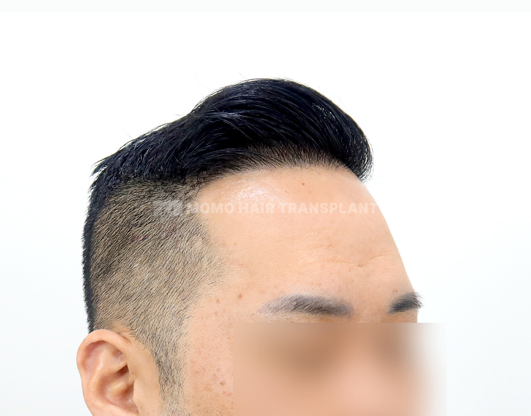 After
