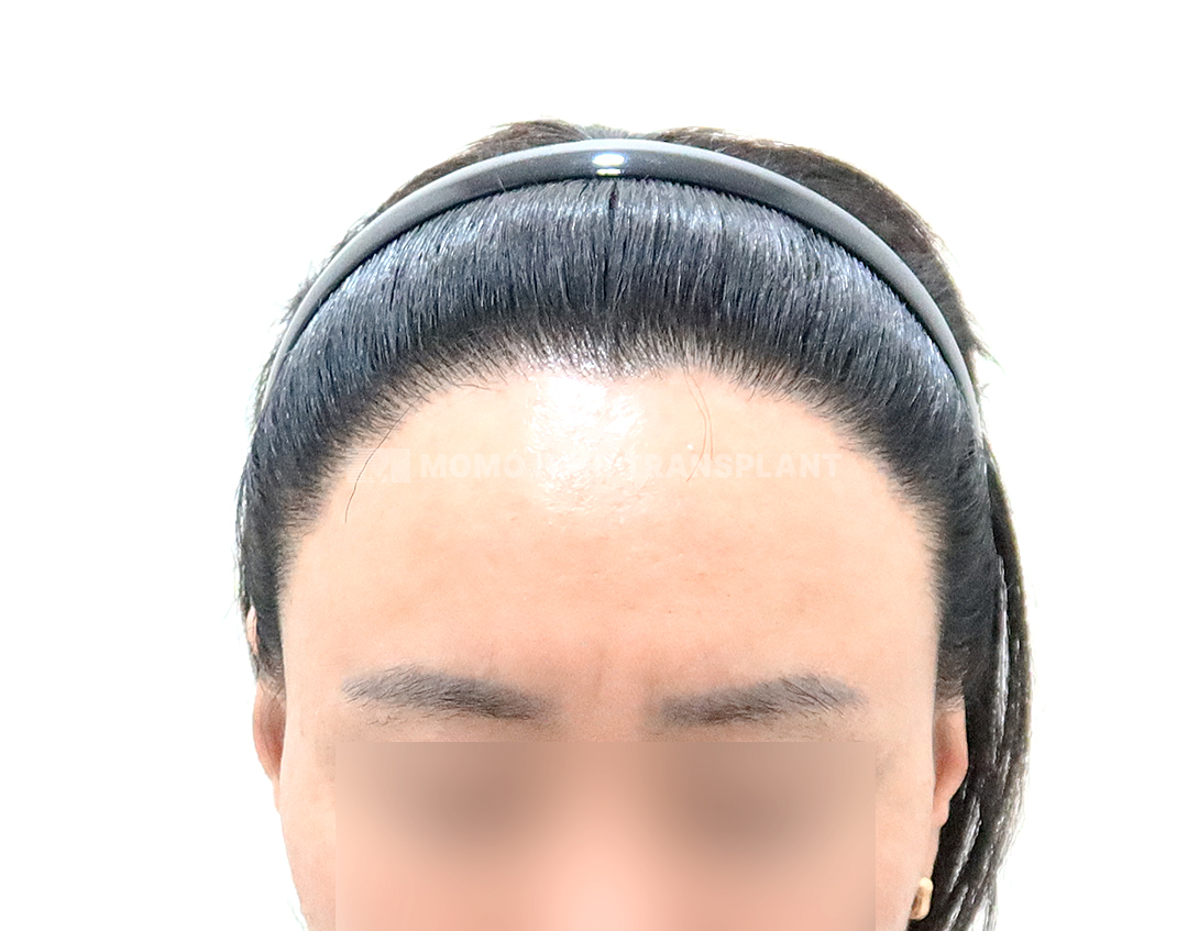 After