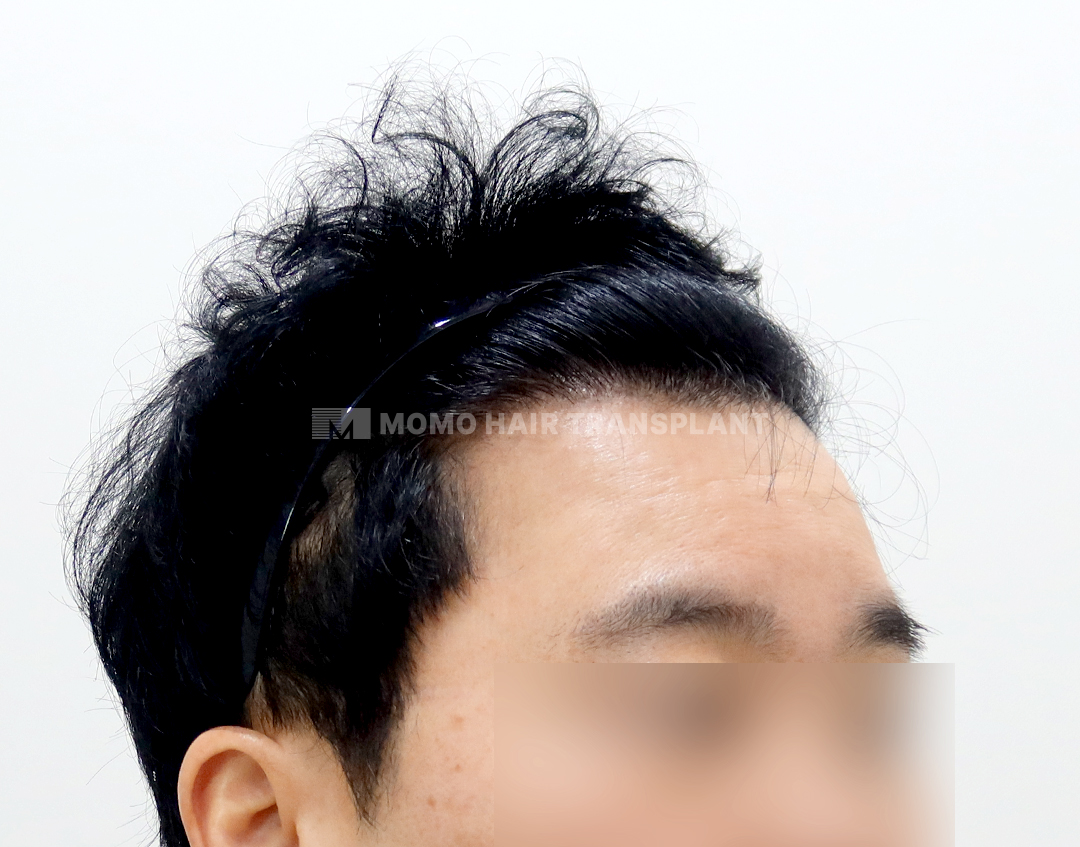 After
