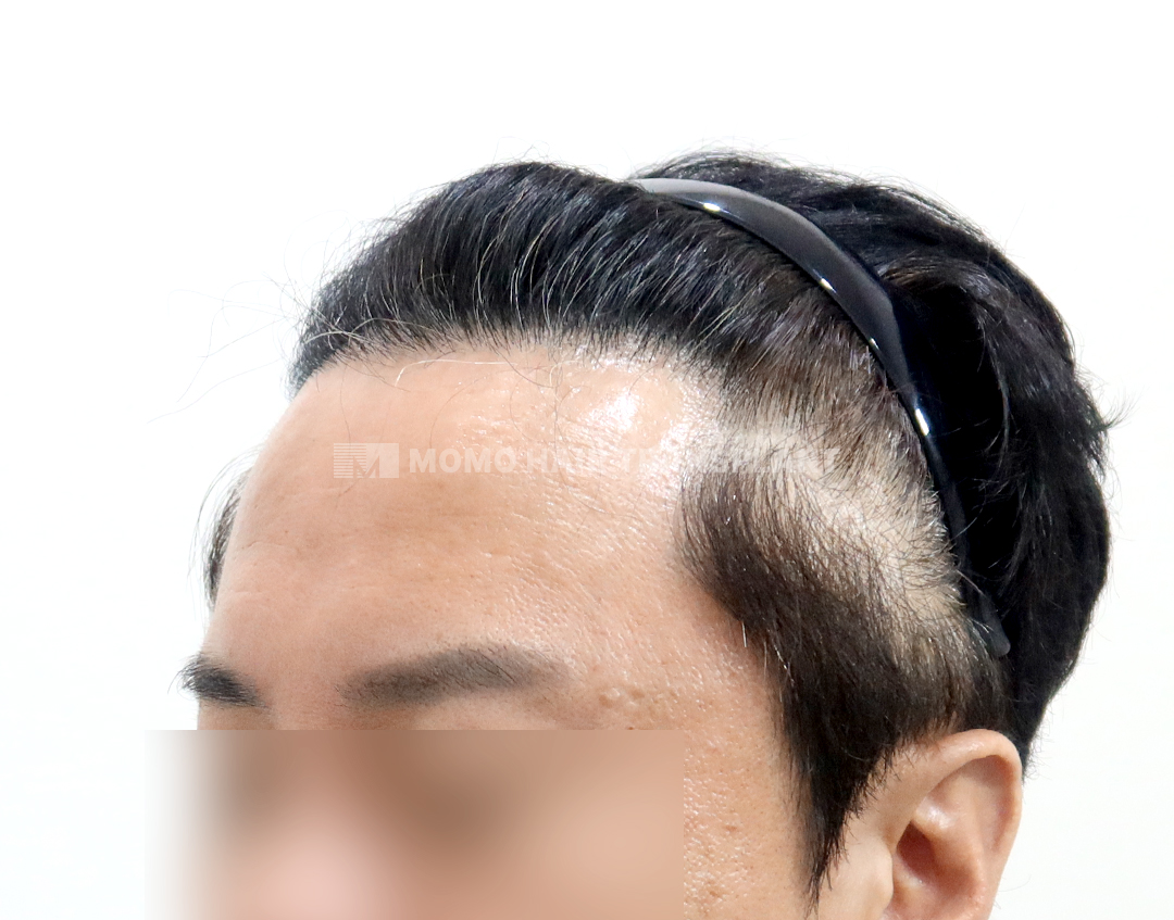 After