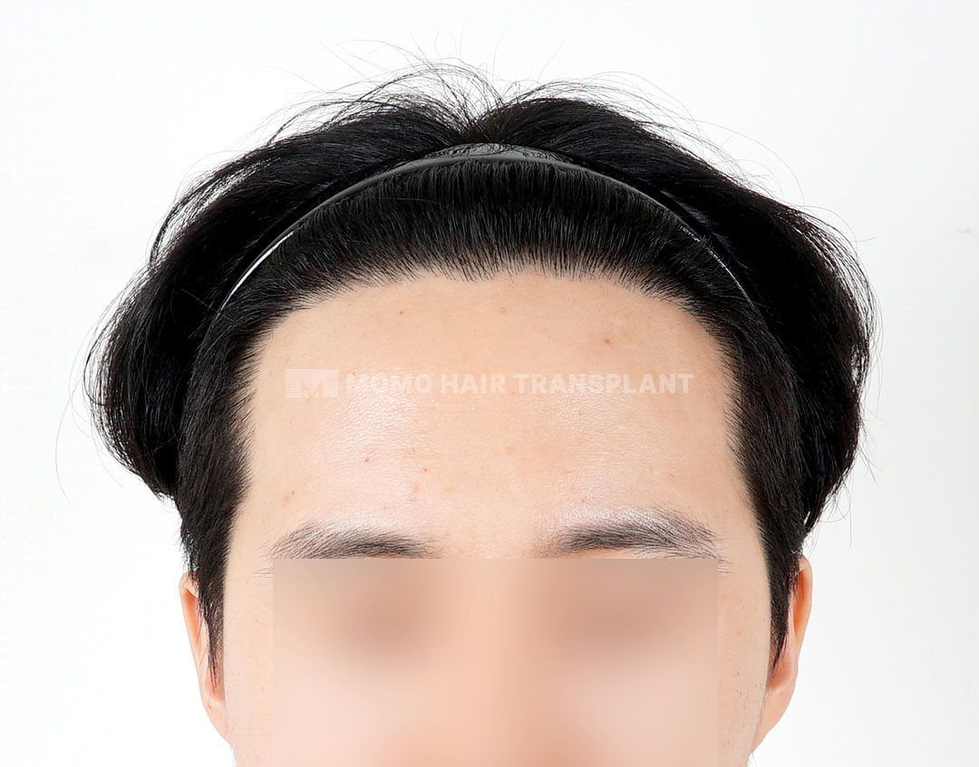 After