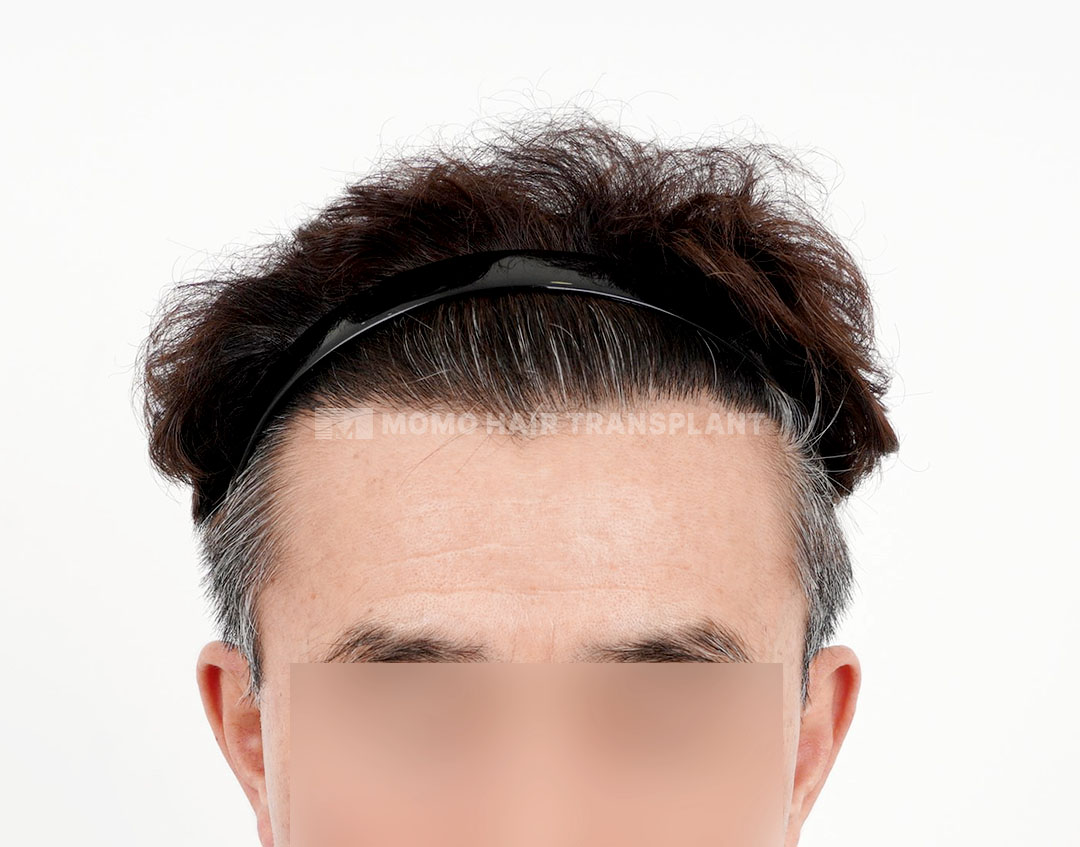 After