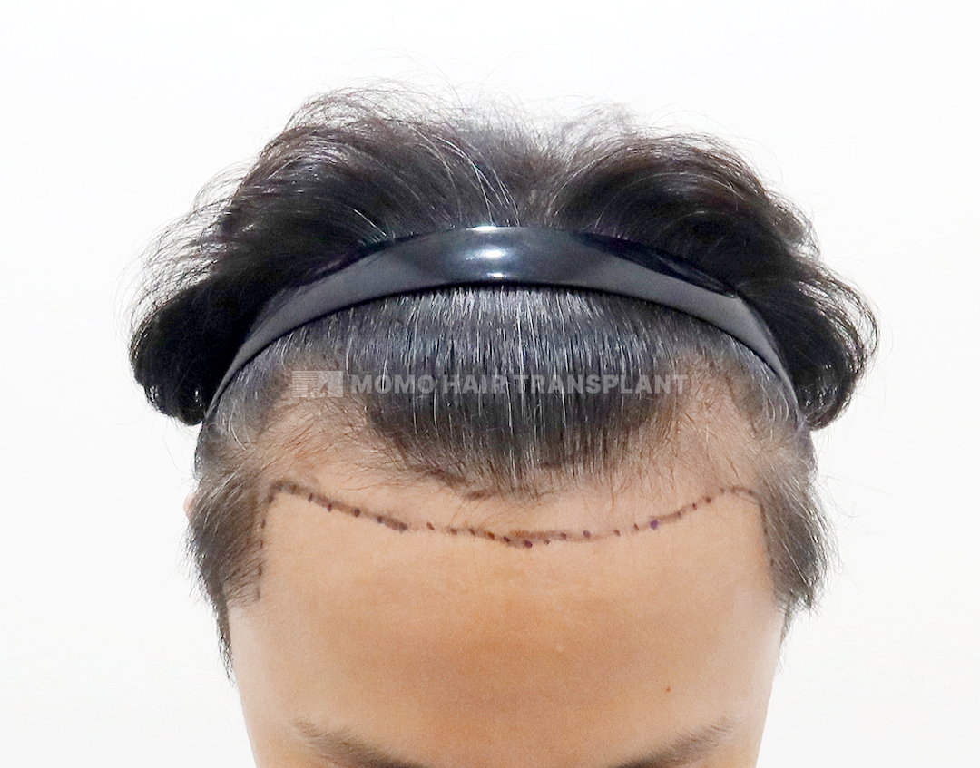 Before