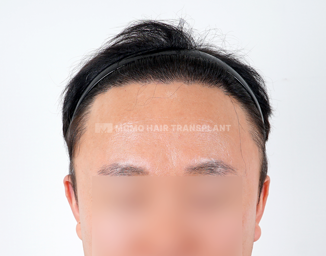 After