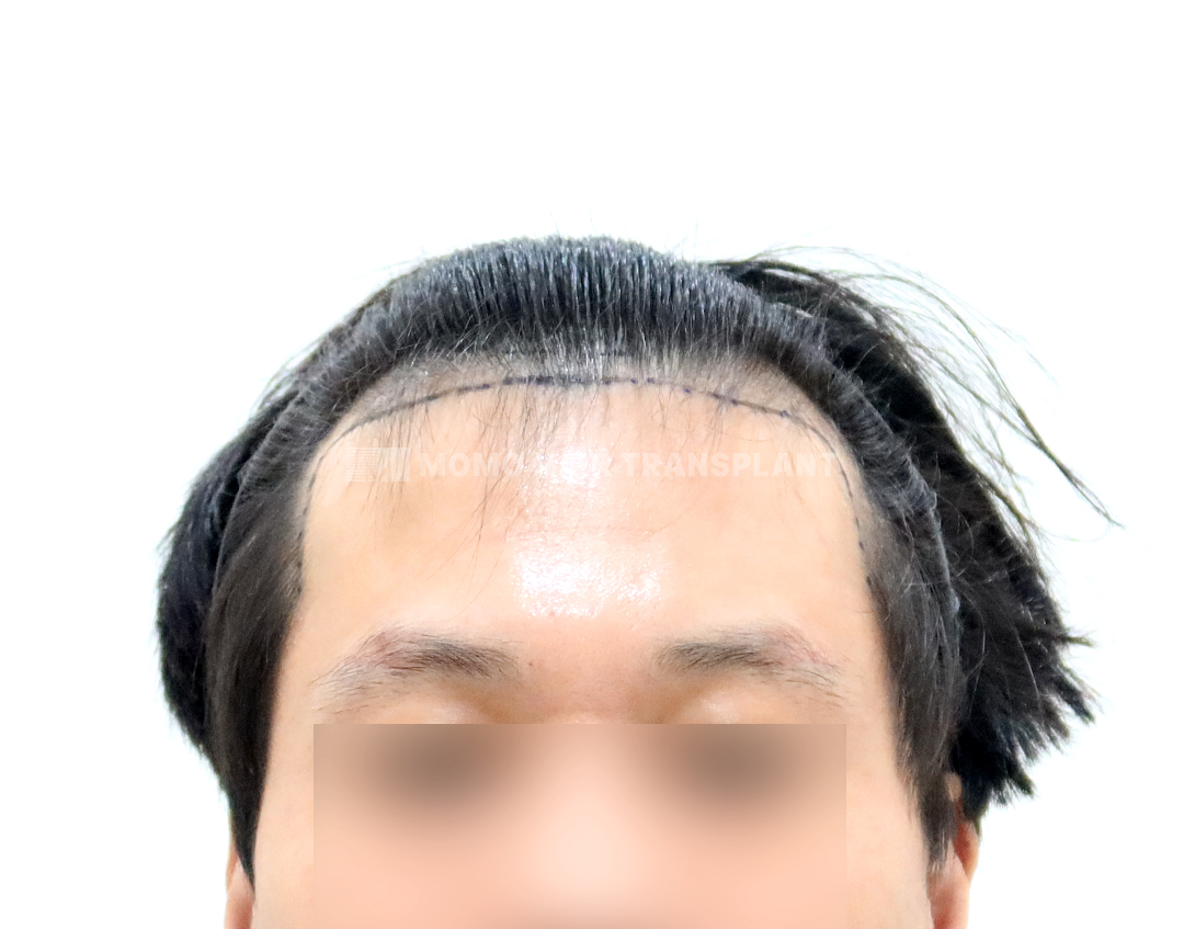 Before