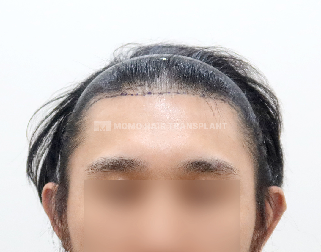 Before