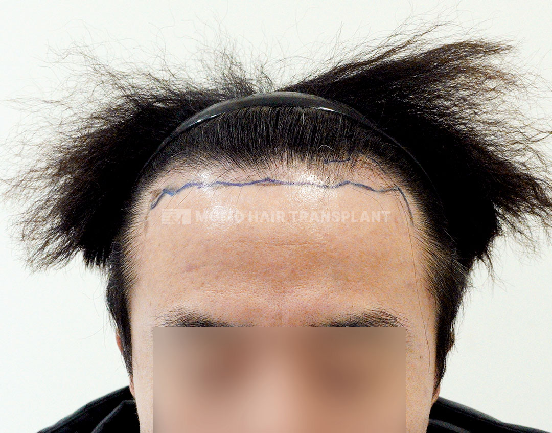 Before