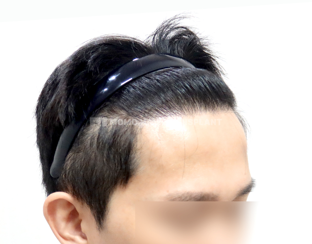 After