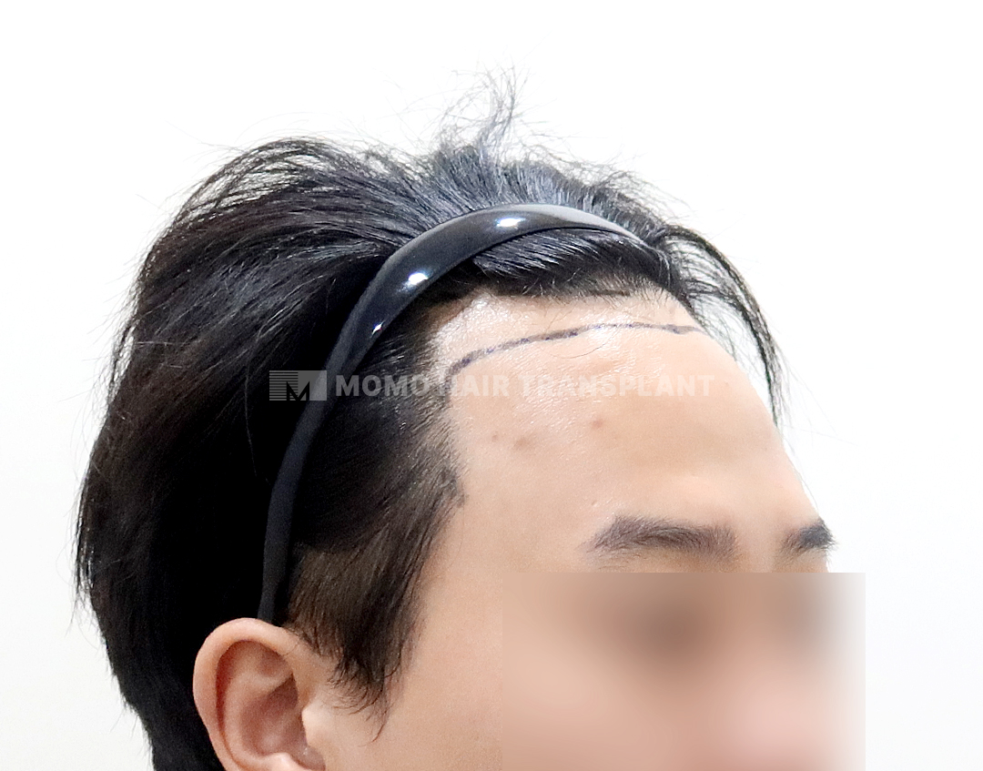 Before