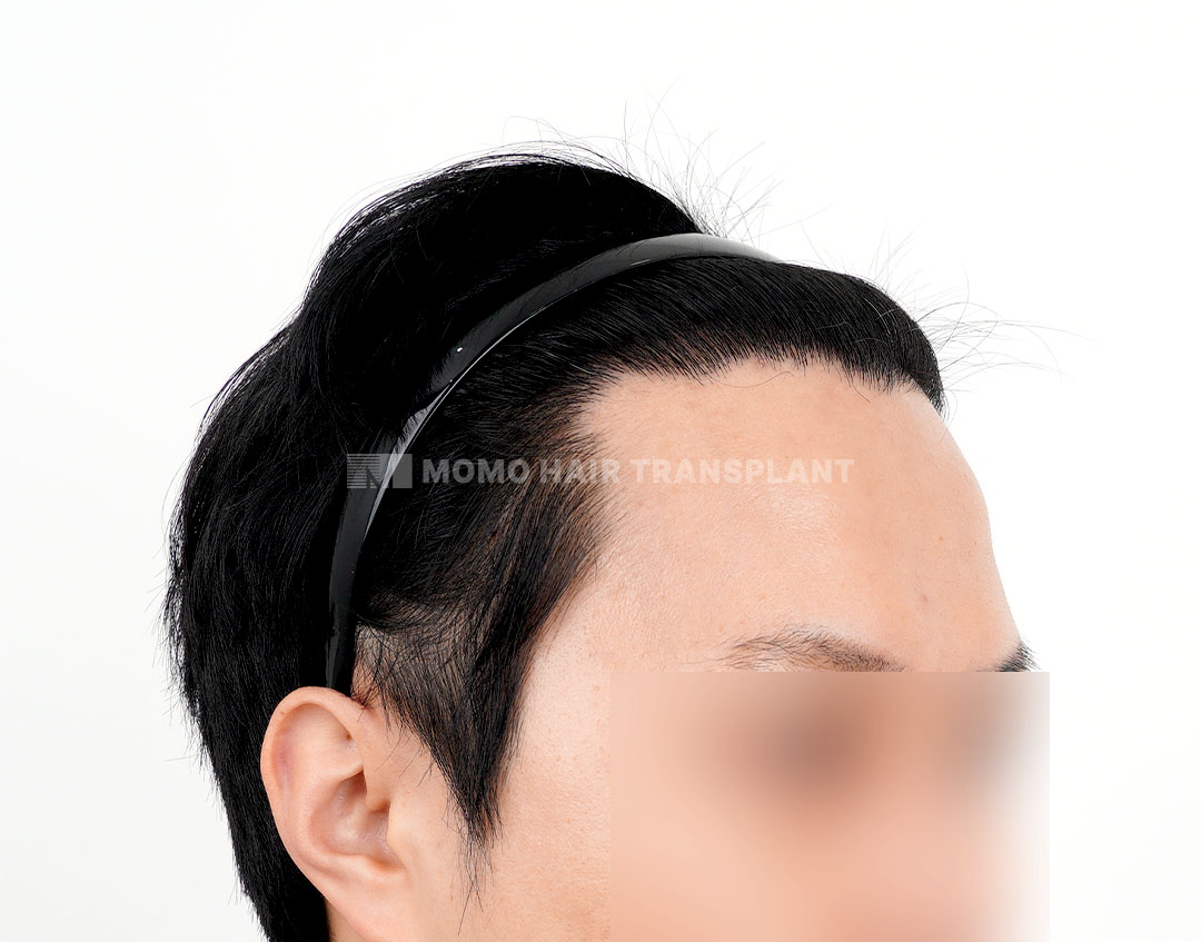 After
