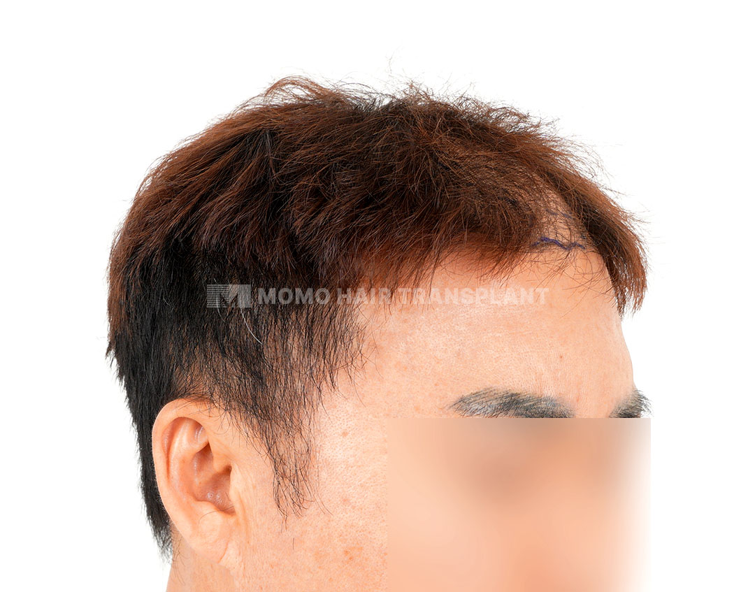 Before