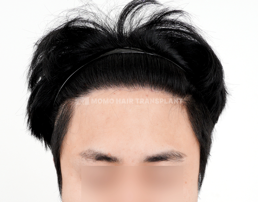 After