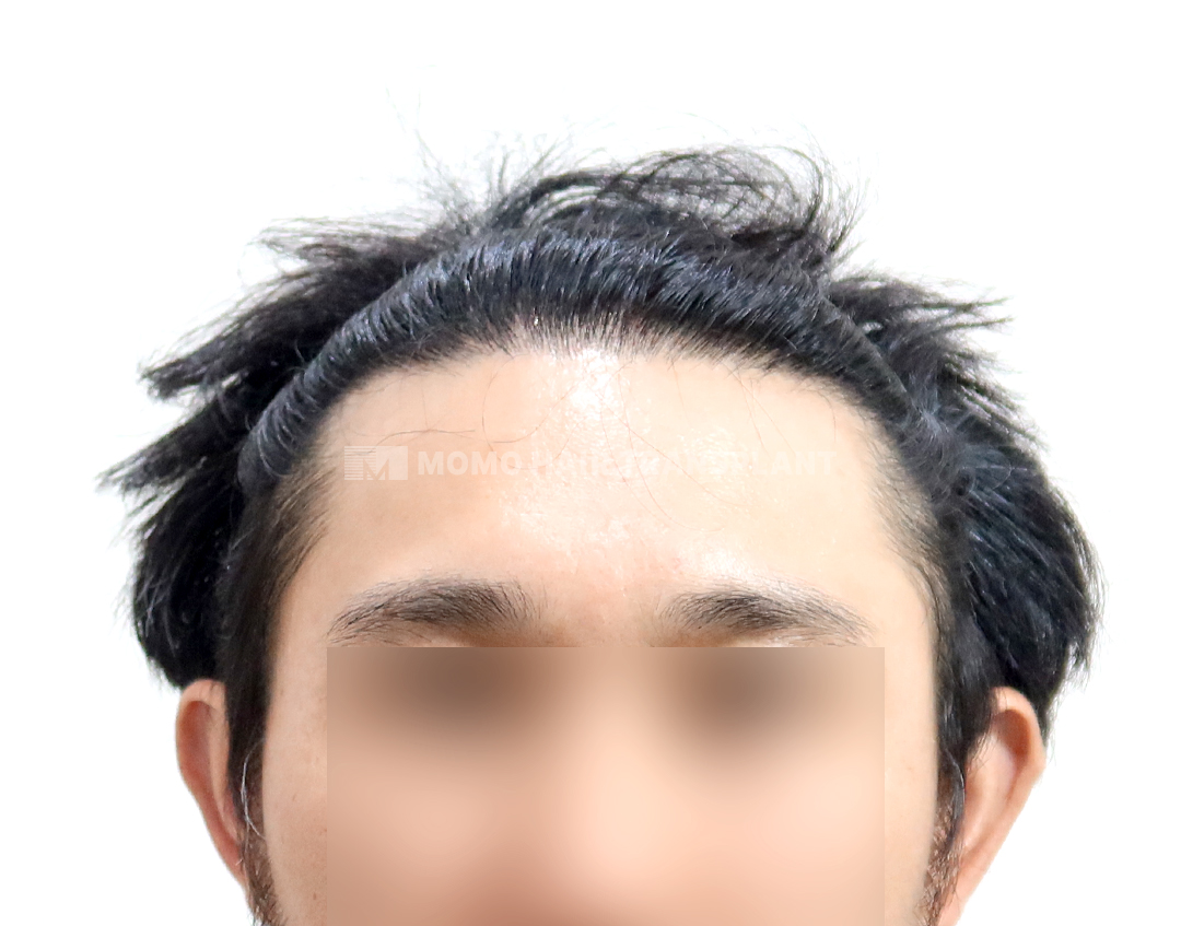 After