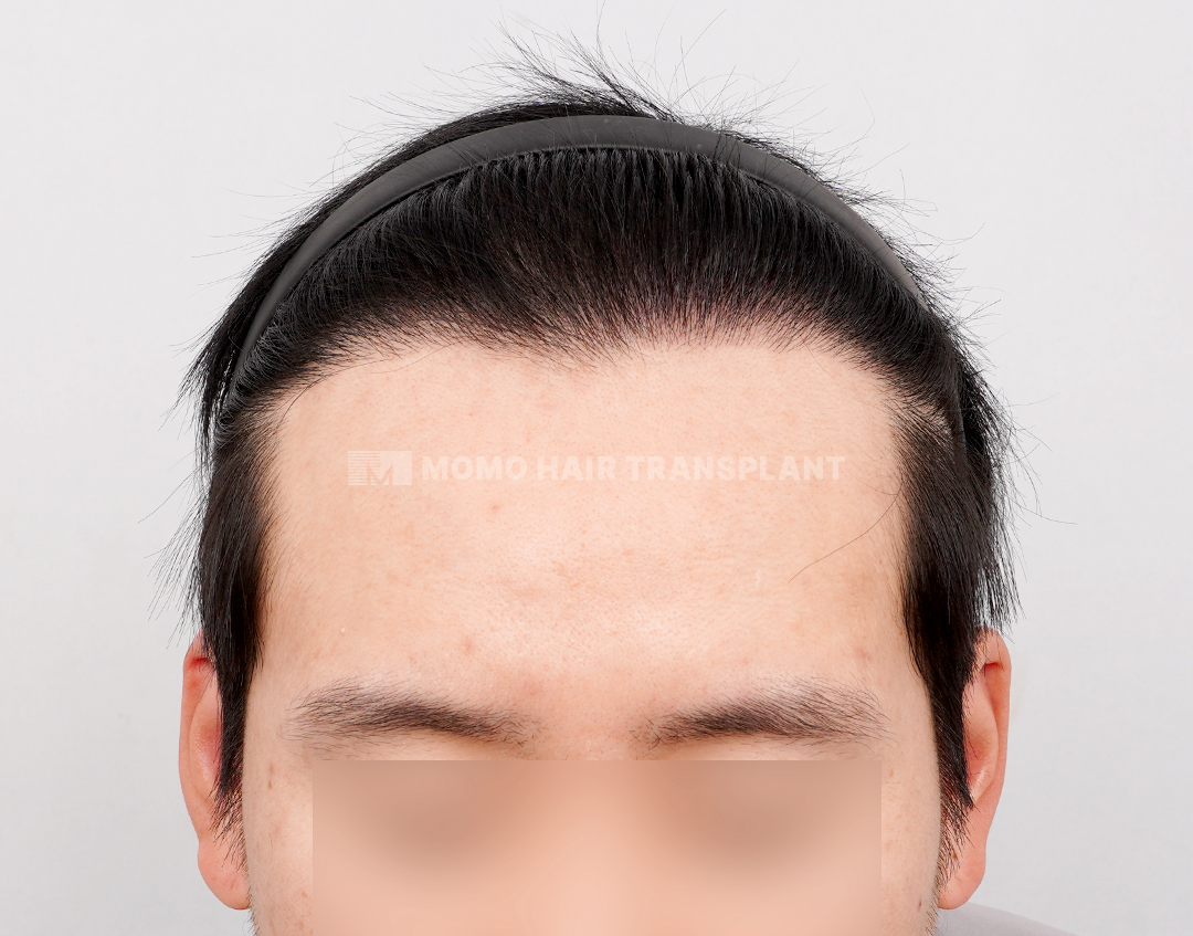 After