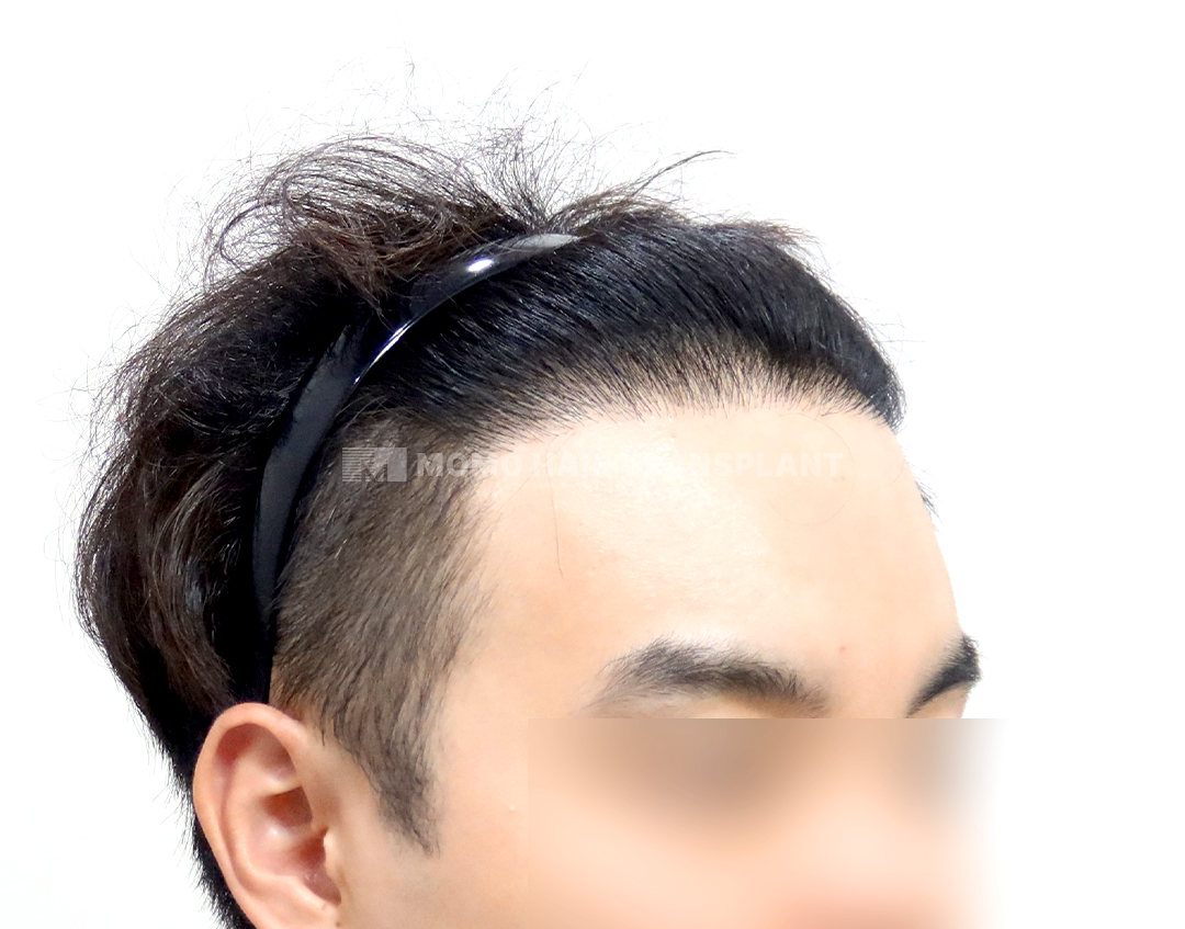 After