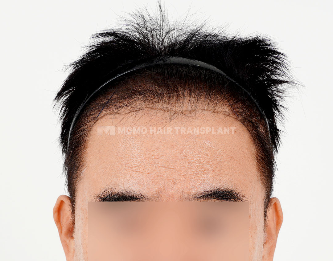 Before
