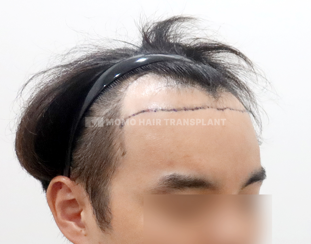 Before