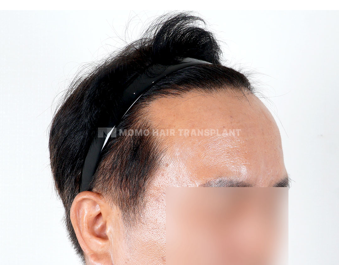 After