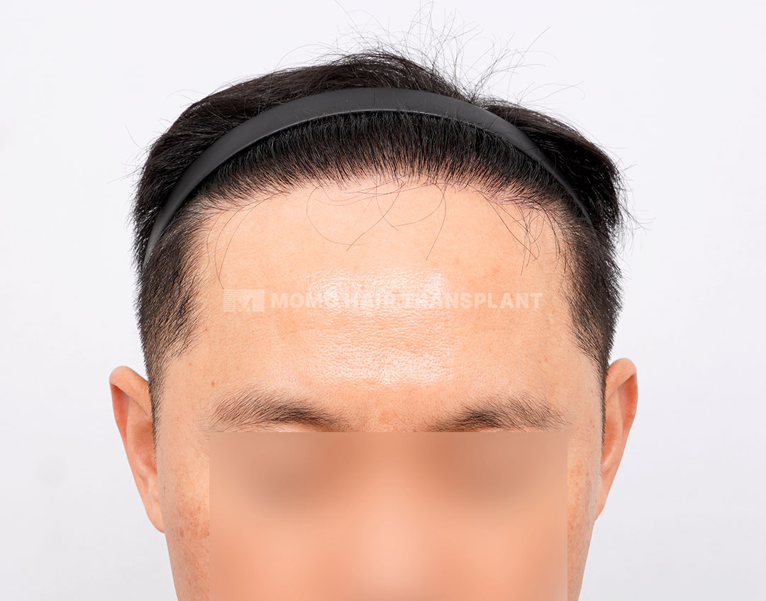 After