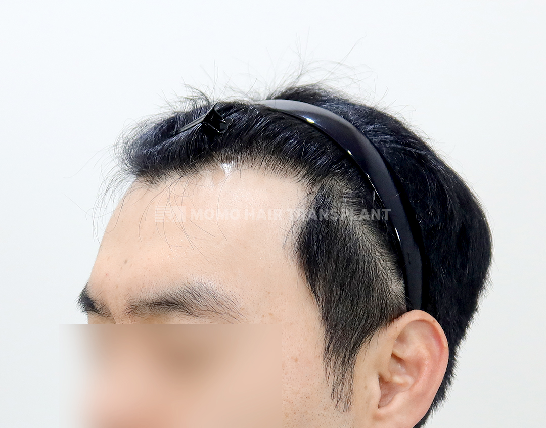 After
