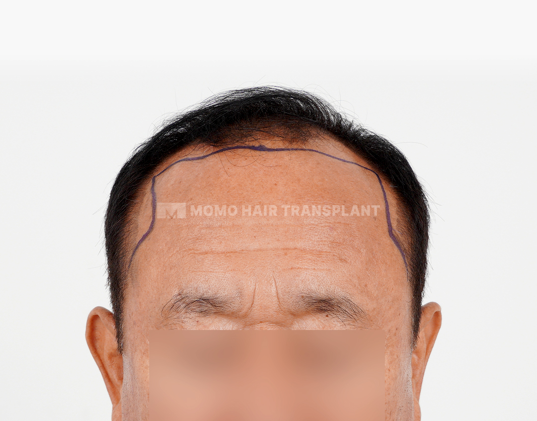 Before
