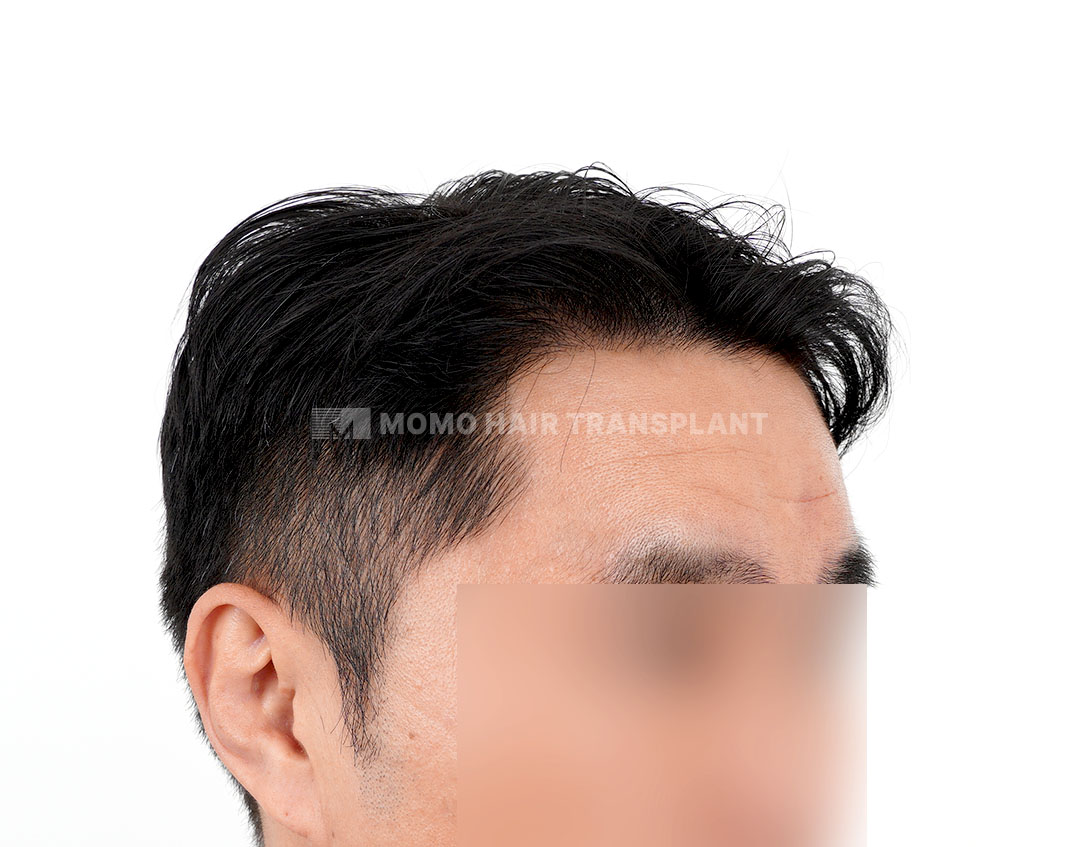 After