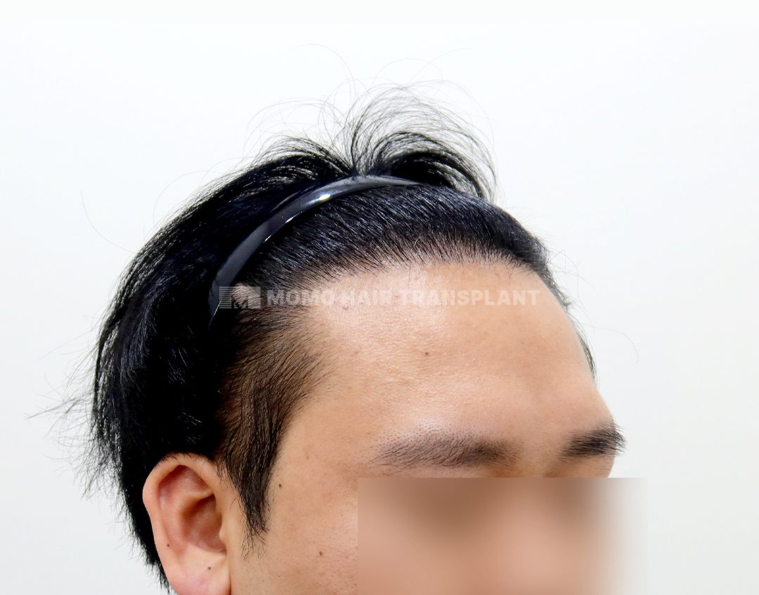 After