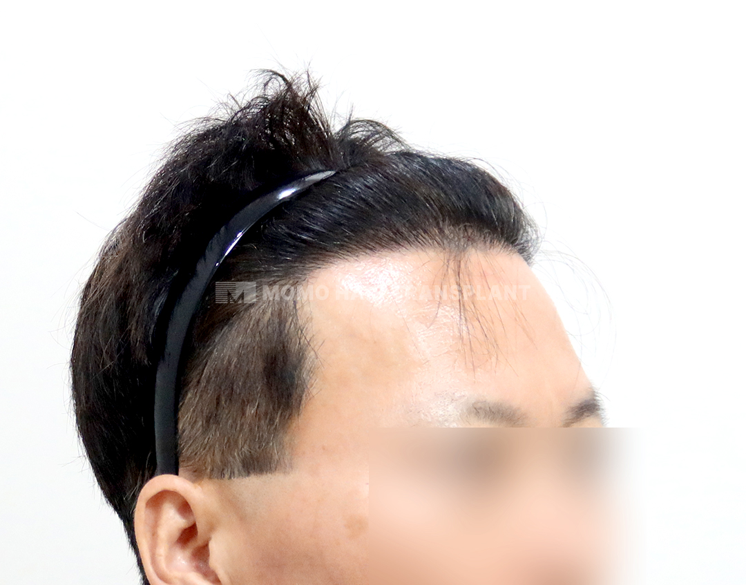 After