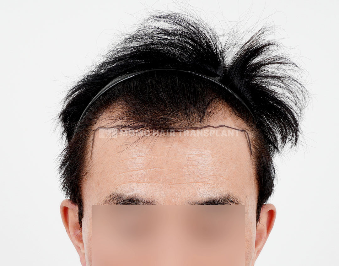 Before