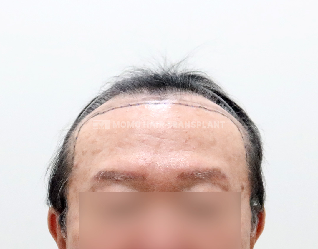 Before
