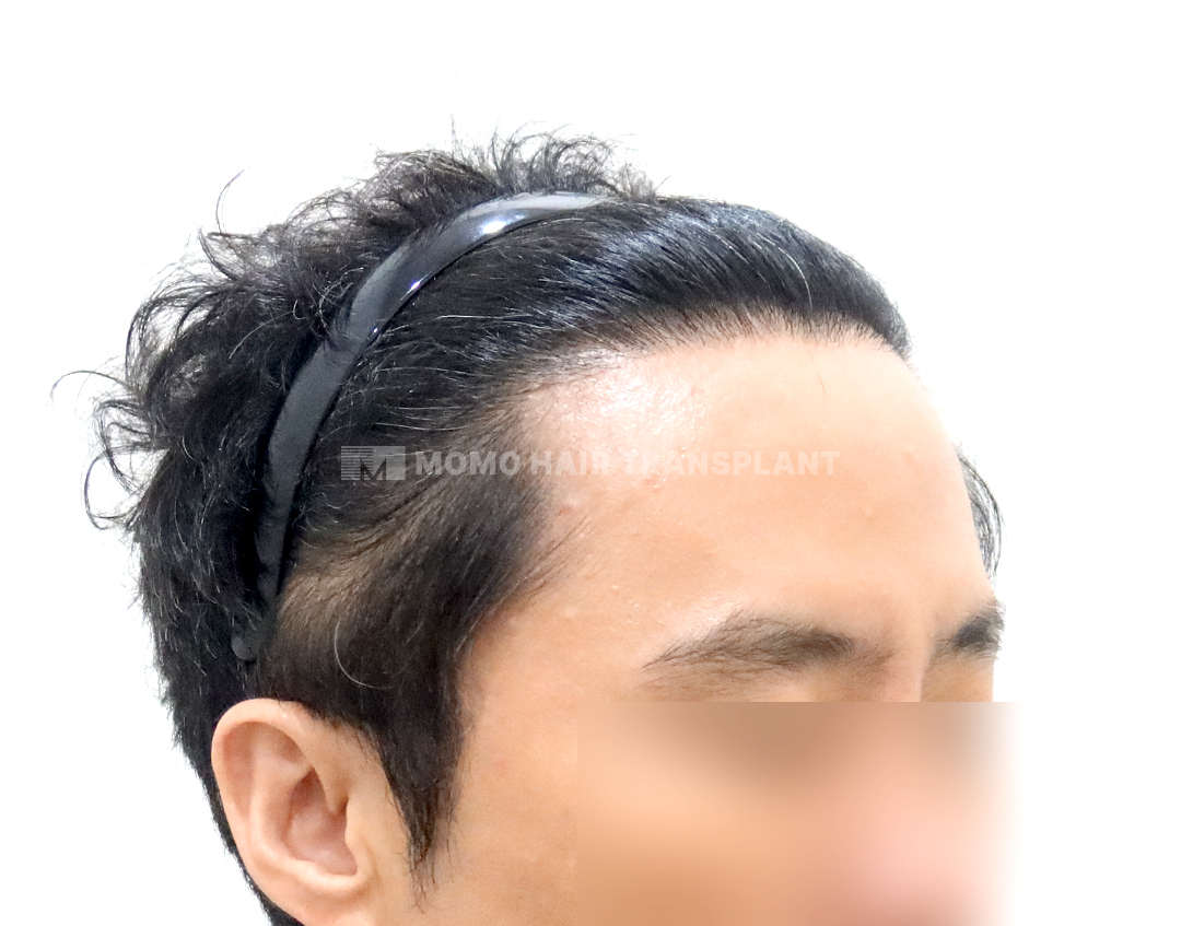 After