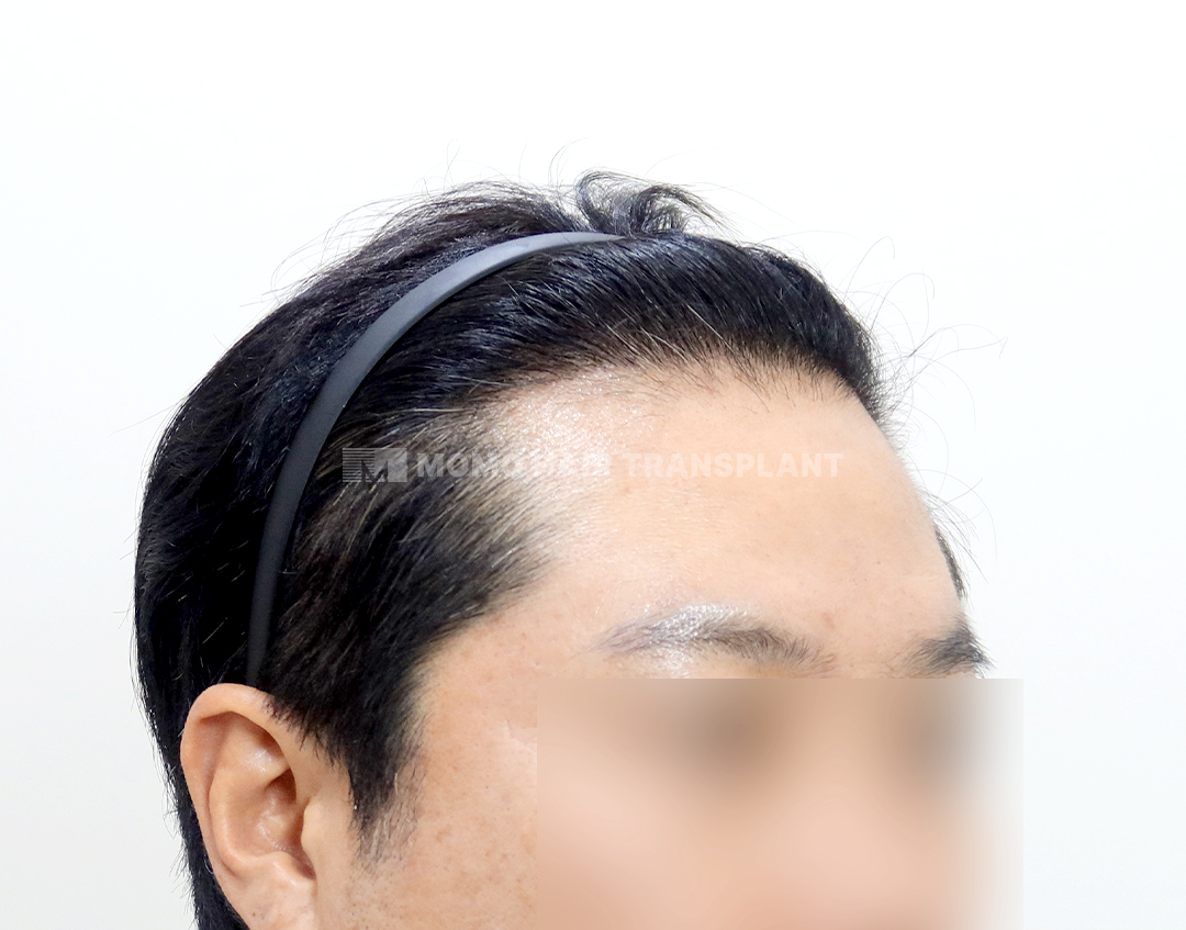After