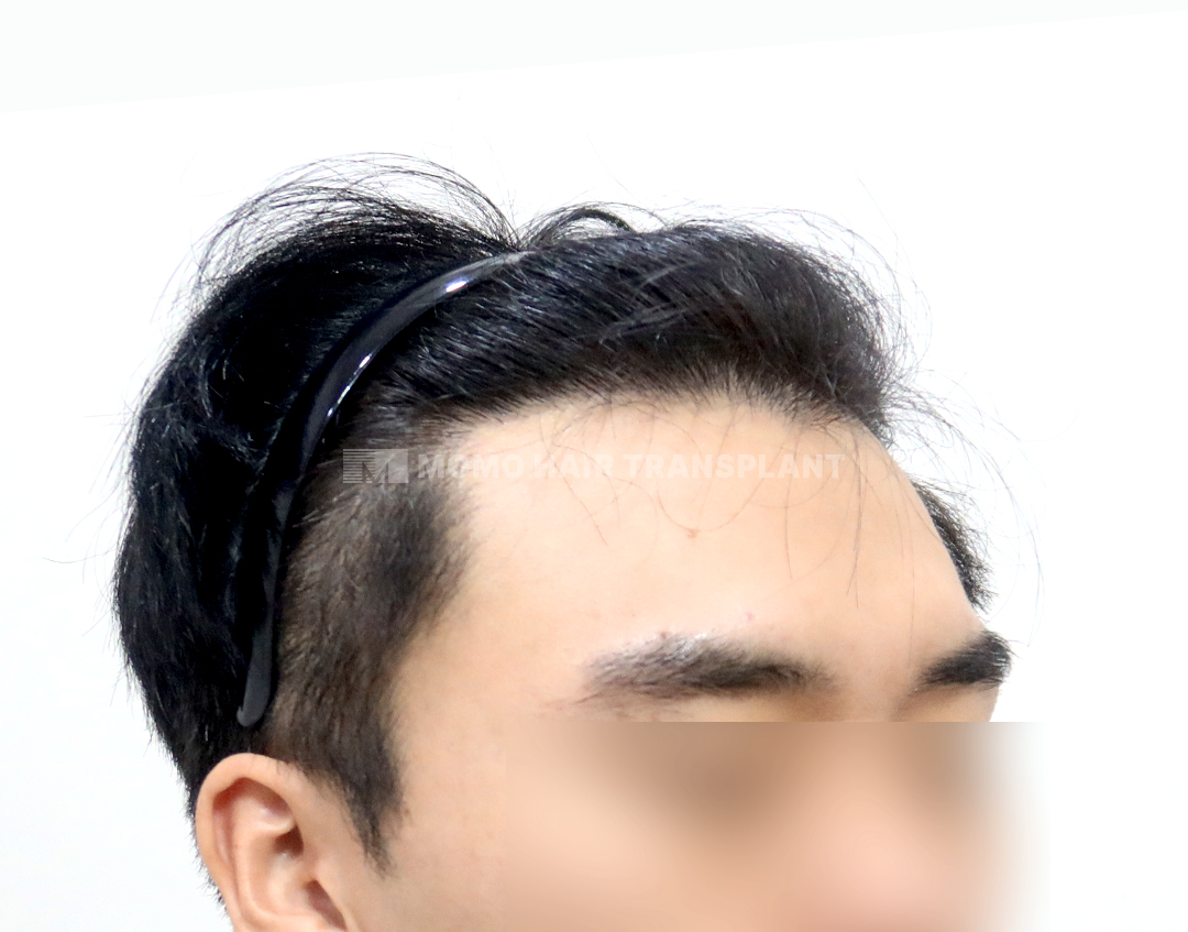 After