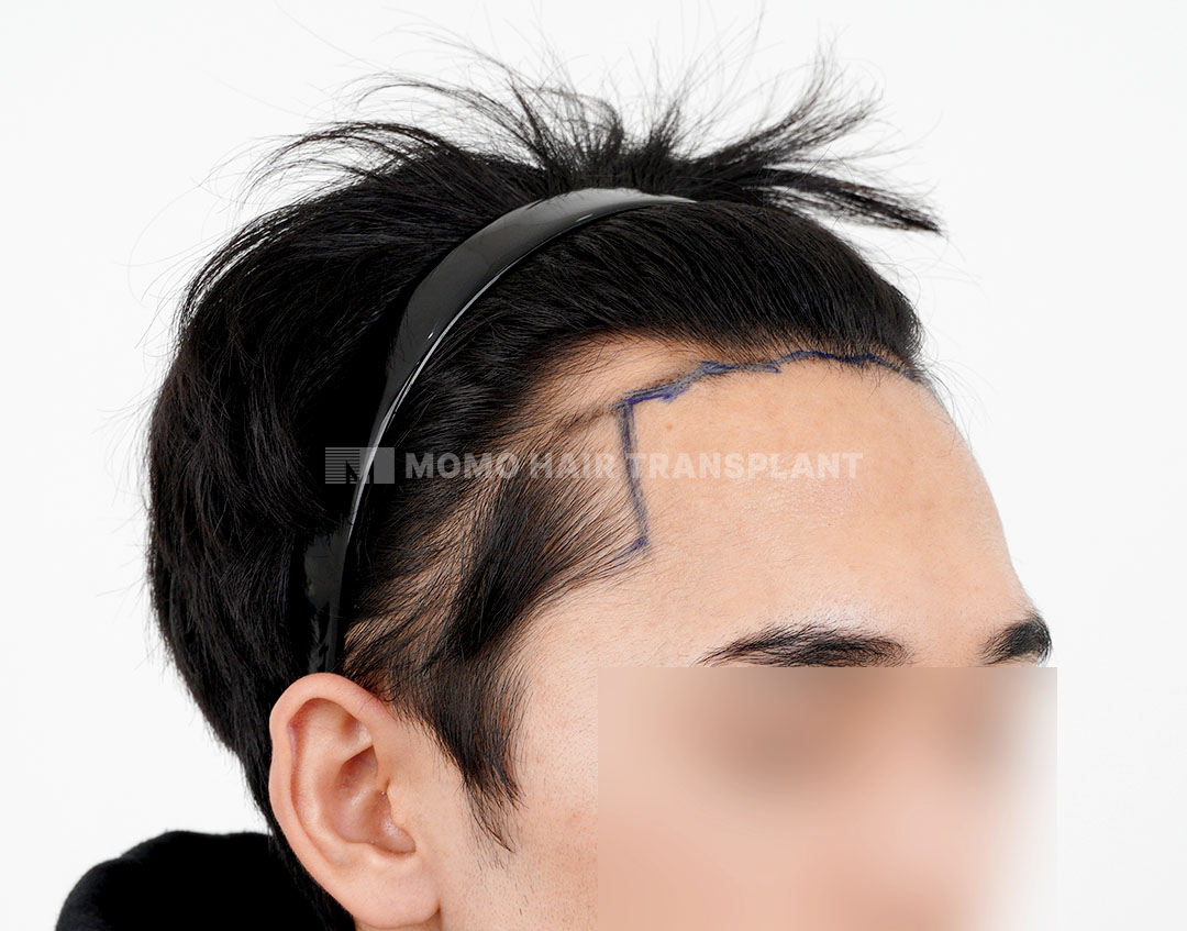 Before