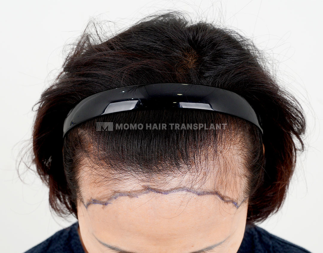 Before