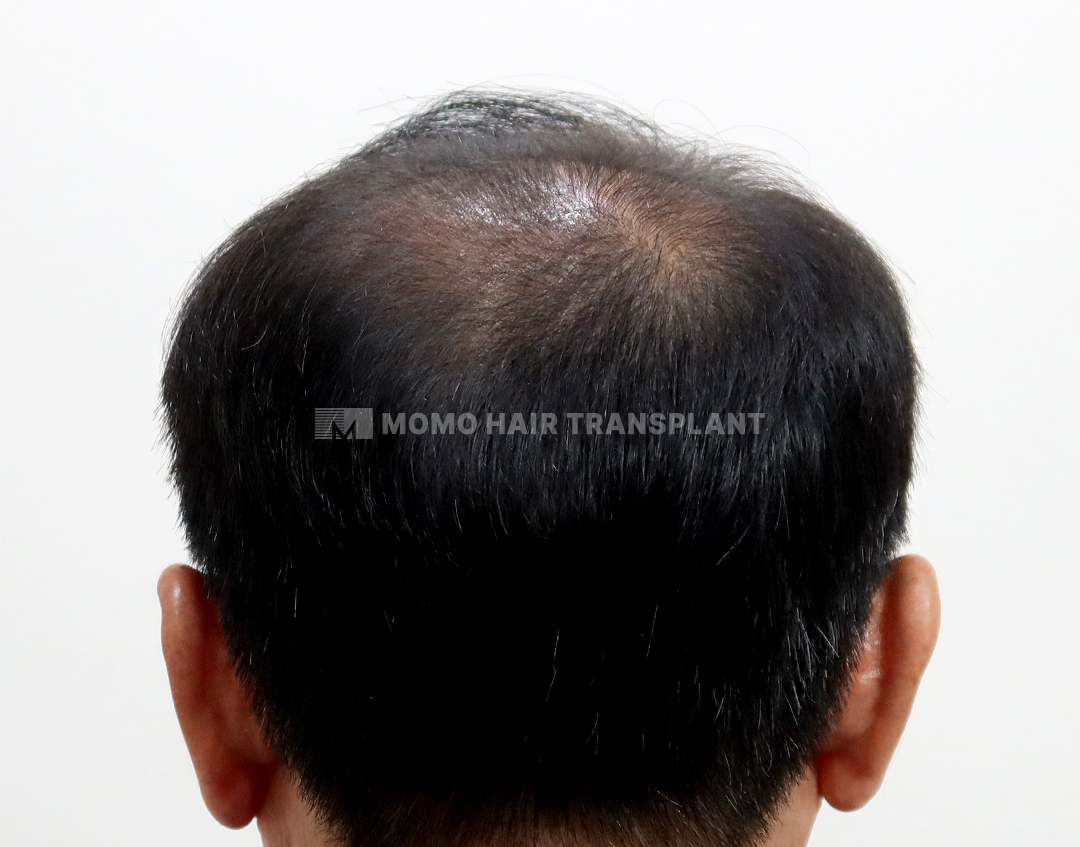 After